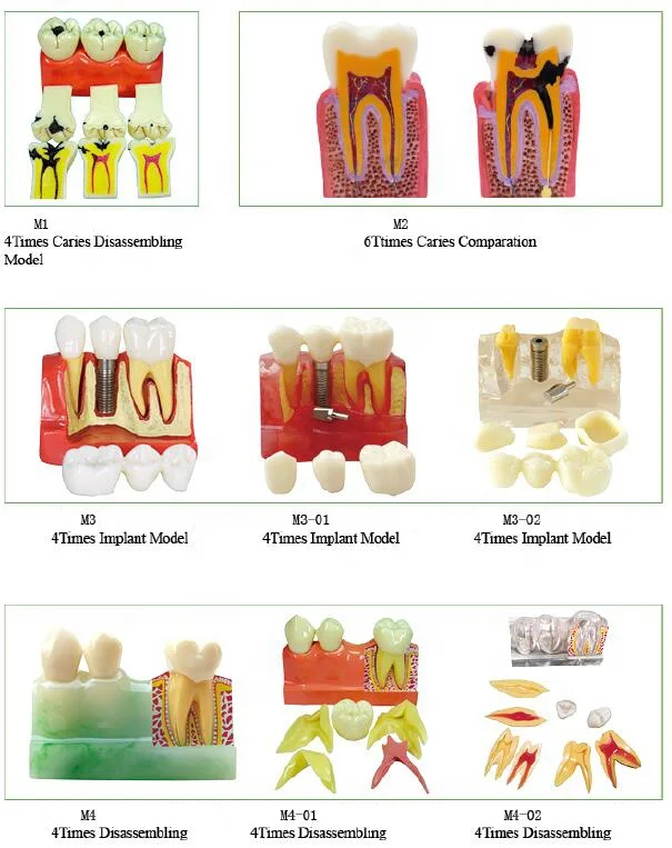 Dental teeth Anesthesia Extraction Model with buzzer