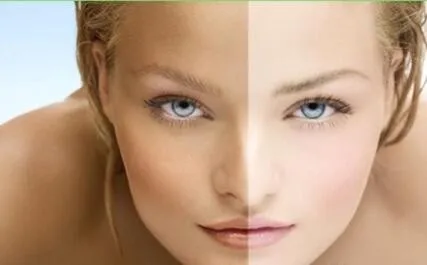 Free Sample Natural Anti Freckle Skin Lightening Whitening Marks Cream And Day and Night  Whitening Cream For Body and Face