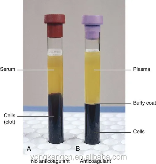 ACD sodium citrate gel Platelet rich plasma PRP tube