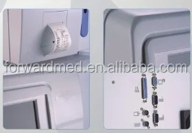 Auto Hematology Analyze (18 Parameters)