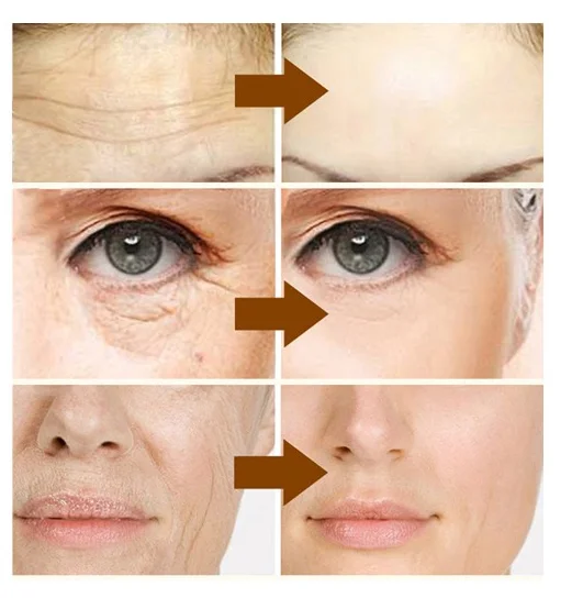 Vitamin C Liquid Serum Anti-aging Whitening VC hyaluronic acid Face Serum Moisturising Brighten Facial Skin Care