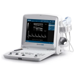 Edan ultrasound machine /ultrasound portable edan dus 60