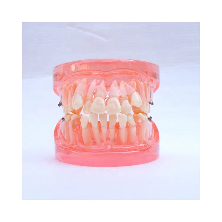 dental education orthodontic model