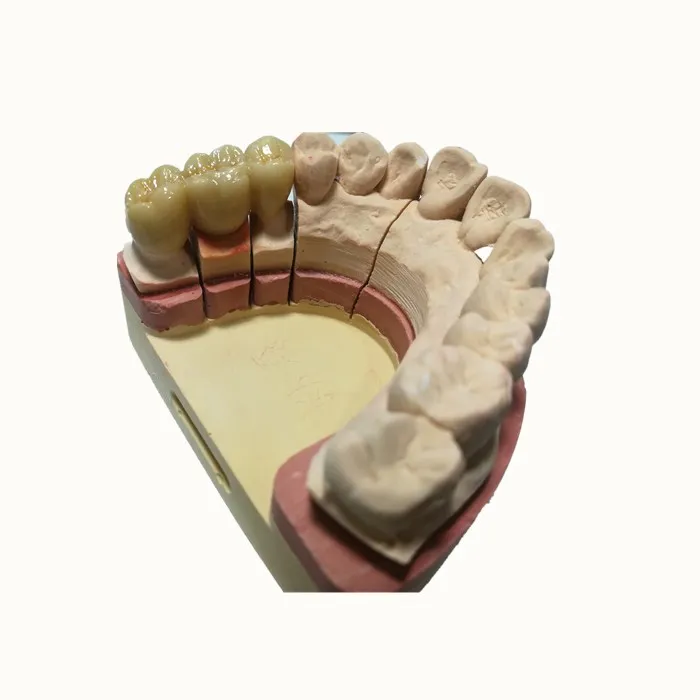 
Good metal and porcelain false teeth 