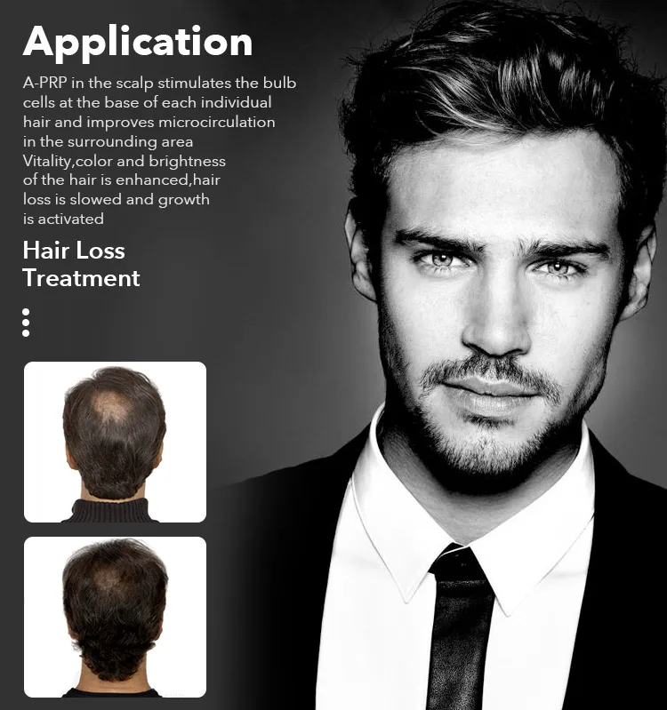 Virtuose Hair Loss Treatment Plasma PRP Kit with Biotin