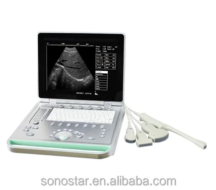 Ultrasound Machine For Veterinary / Human Sonostar Portable Laptop Ultrasound Machine