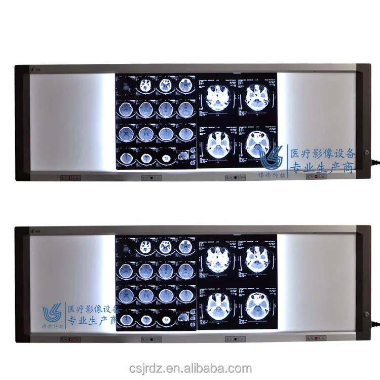 X-Ray film viewer JD-01DIII Brightness adjustable and Film sensor