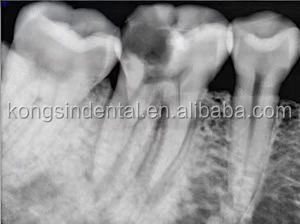 Original Korea Vatech Ez Sensor Dental Digital Intra-Oral Sensor