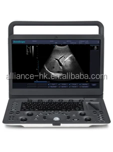 Портативный черно-белый ультразвуковой аппарат Sonoscape 2D E1, экран 15,6 дюйма, жесткий диск 500 ГБ, Wi-Fi доступен