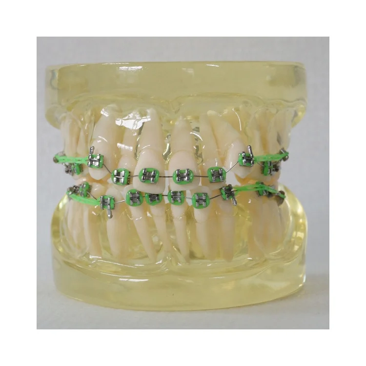 dental education orthodontic model