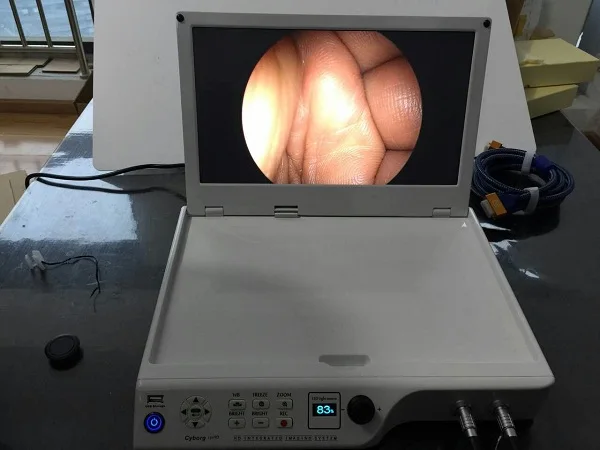 Surgical instruments endoscope camera/HD medical camera 16 inch