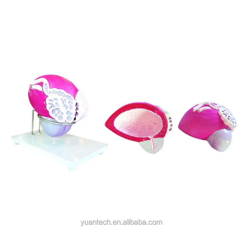 Enlarged Plastic Bladder and Prostate Anatomy Structure Model,urinary system model