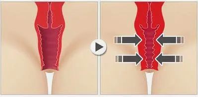 2016 новые лазеры для хирургии и медицины, оборудование для омоложения жидкости