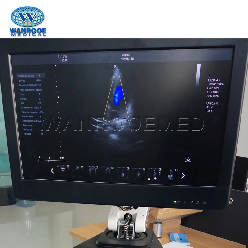 USC80Plus Medical Pregnancy OB/GYN Abdomen Fetal Portable Diagnostic Ultrasound Machine for Sale