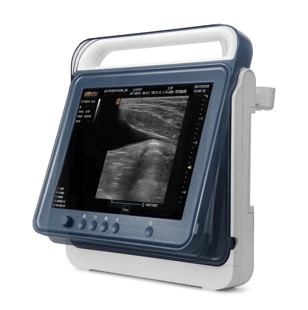 UTECH PT50CHand-carried color doppler diagnostic ultrasound system, hospital vascular doppler ultrasound