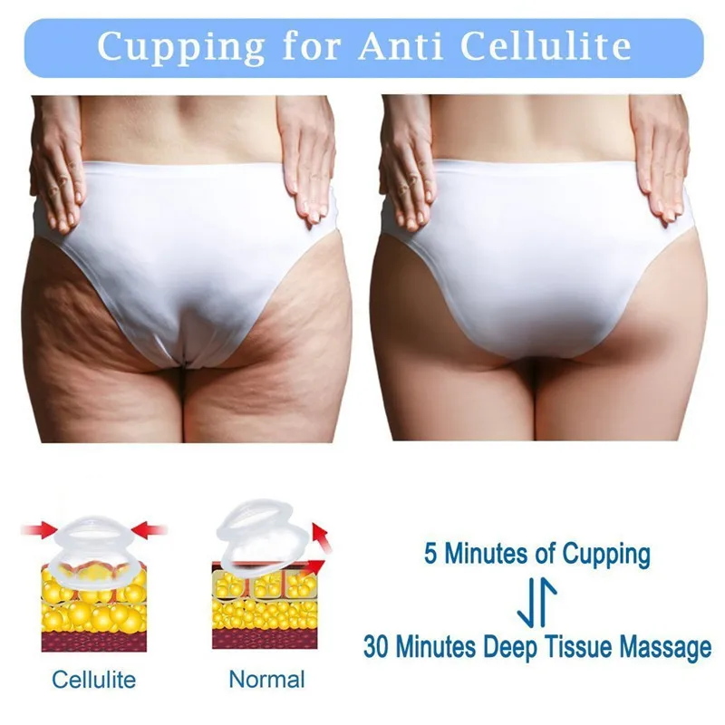 
Anti cellulite body massage cups silicone cupping therapy set 