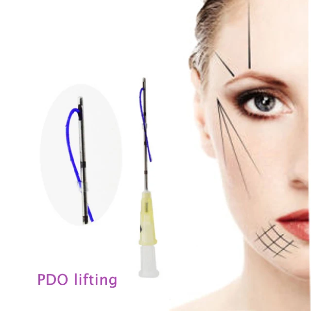 
Absorbable Suture Type face lift pdo threads for face lifting 