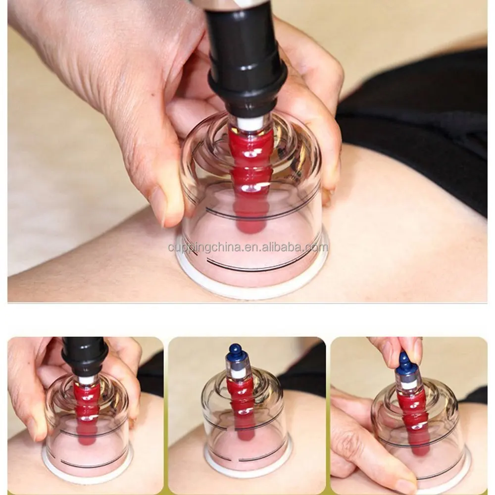 Премиум качество Cupping Set w/19 чашек, 10 Acu-указатели давления включены * Лучший комплект