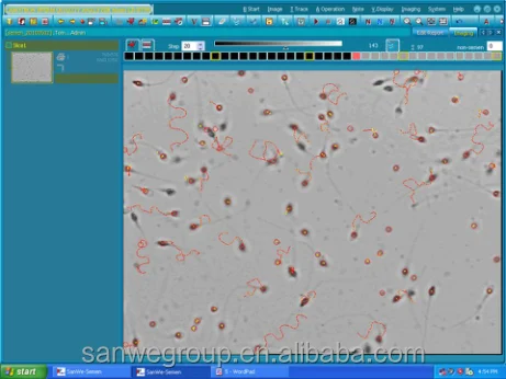 SW-3702  Portable Laptop Semen Analyzer