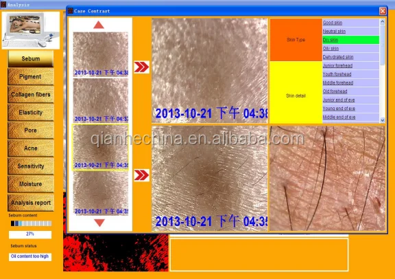 Portable sebum pigment collagen elasticity pore acne sensitivity moisture skin analyzer machine for beauty salon