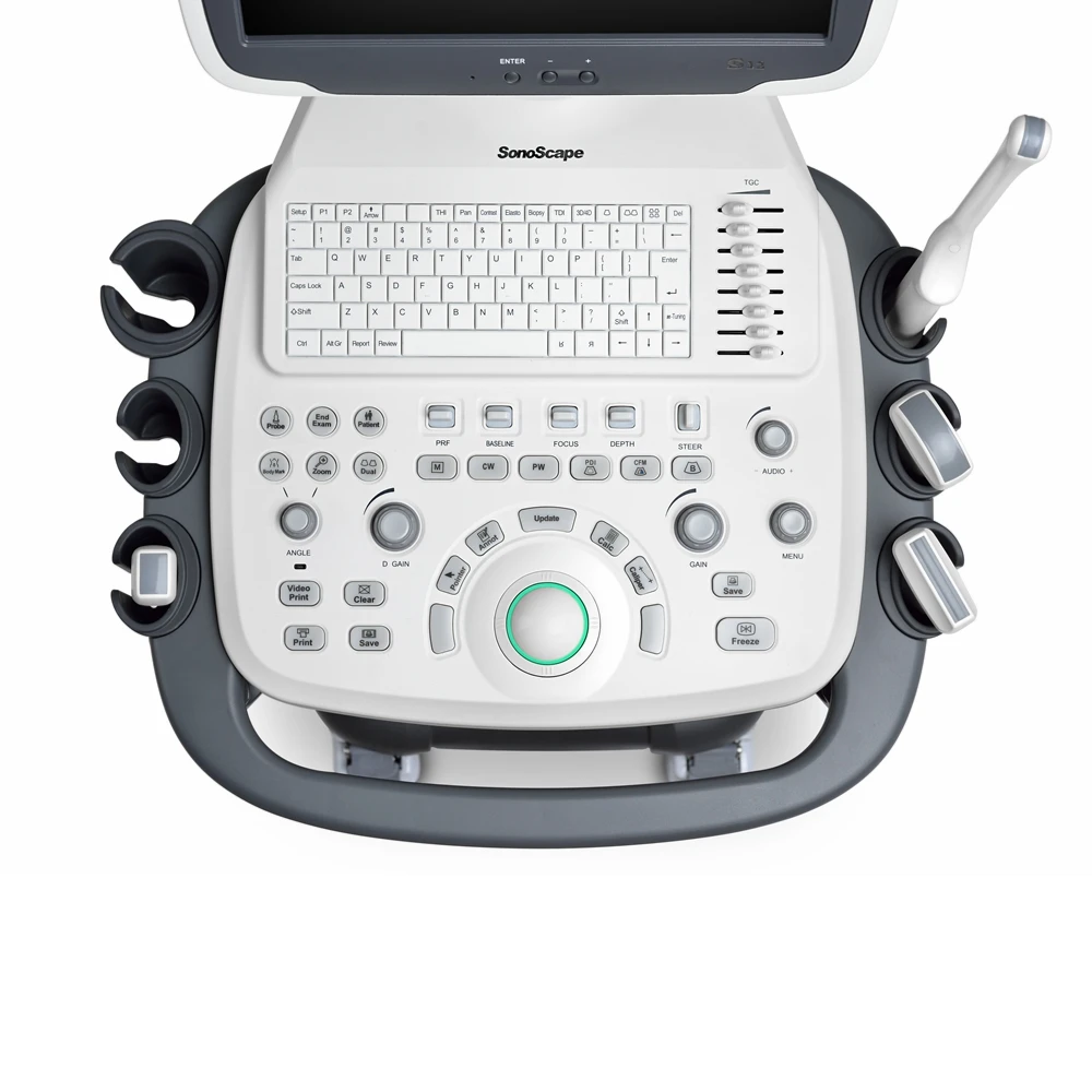 Sonoscape S12 Trolley Color Doppler Cardiac ultrasound machine China price