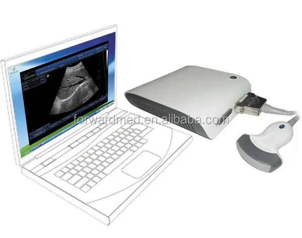 cheapest portable Ultrasound Scanner