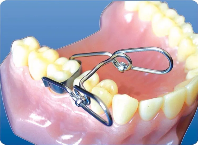 Dentanl Saddle Metal Matrices Universal Kit Dental Sectional Matrix Band Dental Saddle Contoured Metal Russian Band