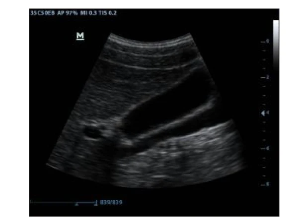
Mindray dp 30 probe ultrasound/mindray veterinary ultrasound 