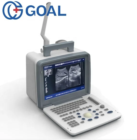 digital ultrasound machine price/ doppler ultrasound