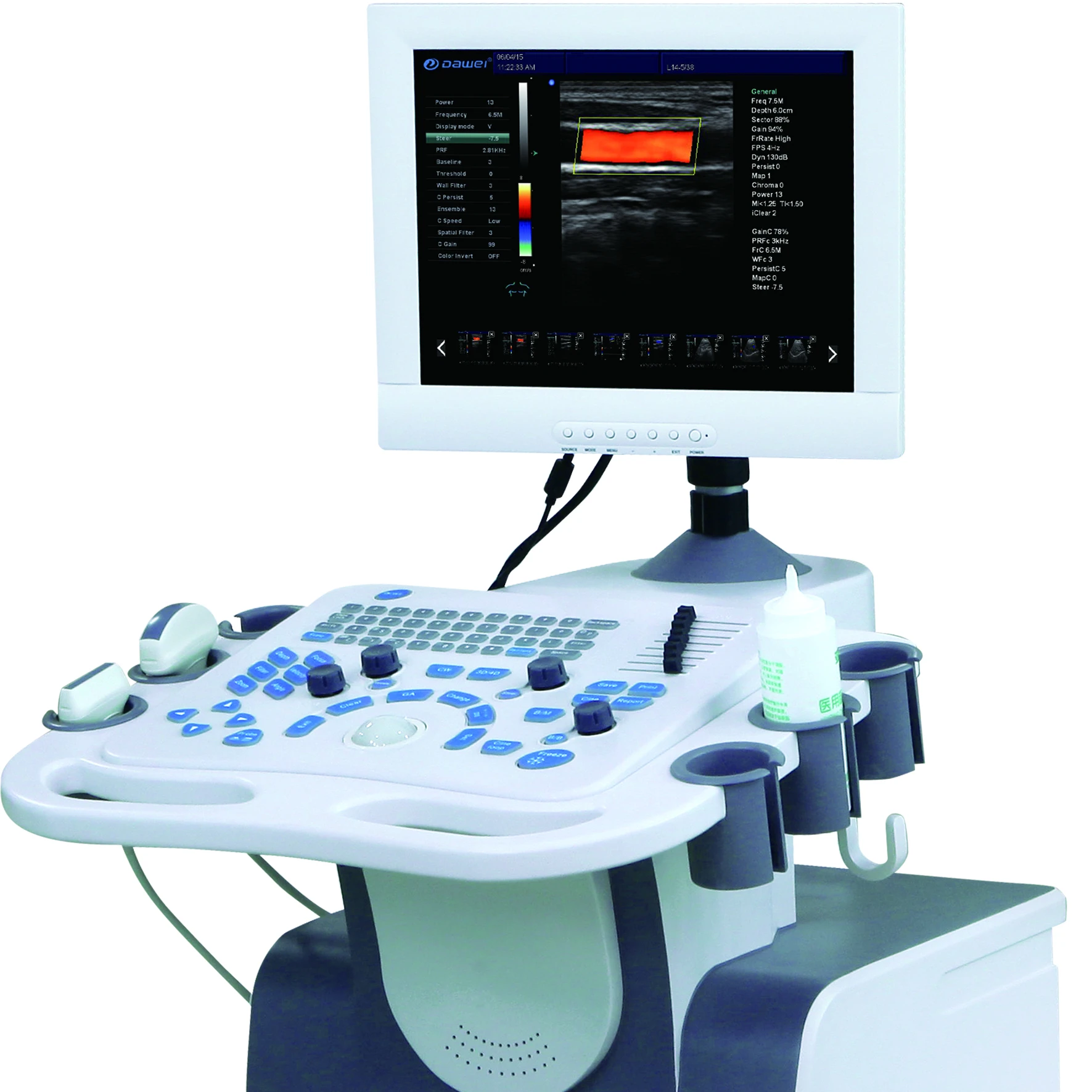 Ультразвуковая диагностическая система Доплера 3D 4D