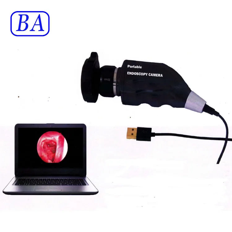 Medical New type HD portable usb endoscope