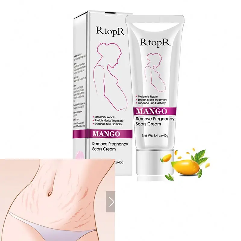 
Mango Remove Pregnancy Scars Acne Cream Stretch Marks Treatment Maternity Repair Anti Aging Anti Firming Body Creams  (62193458590)