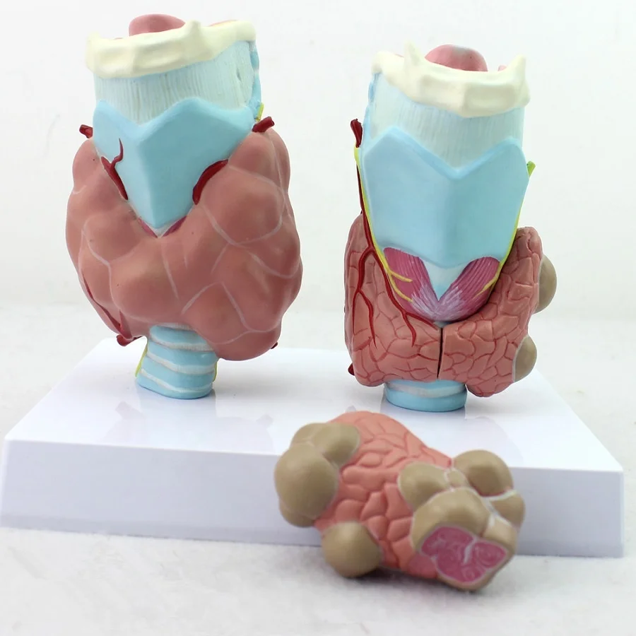 Human thyroid pathology model