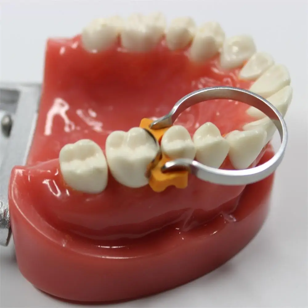 DENTAL SUPPLY DENTAL SECTIONAL CONTOURED MATRICES KIT