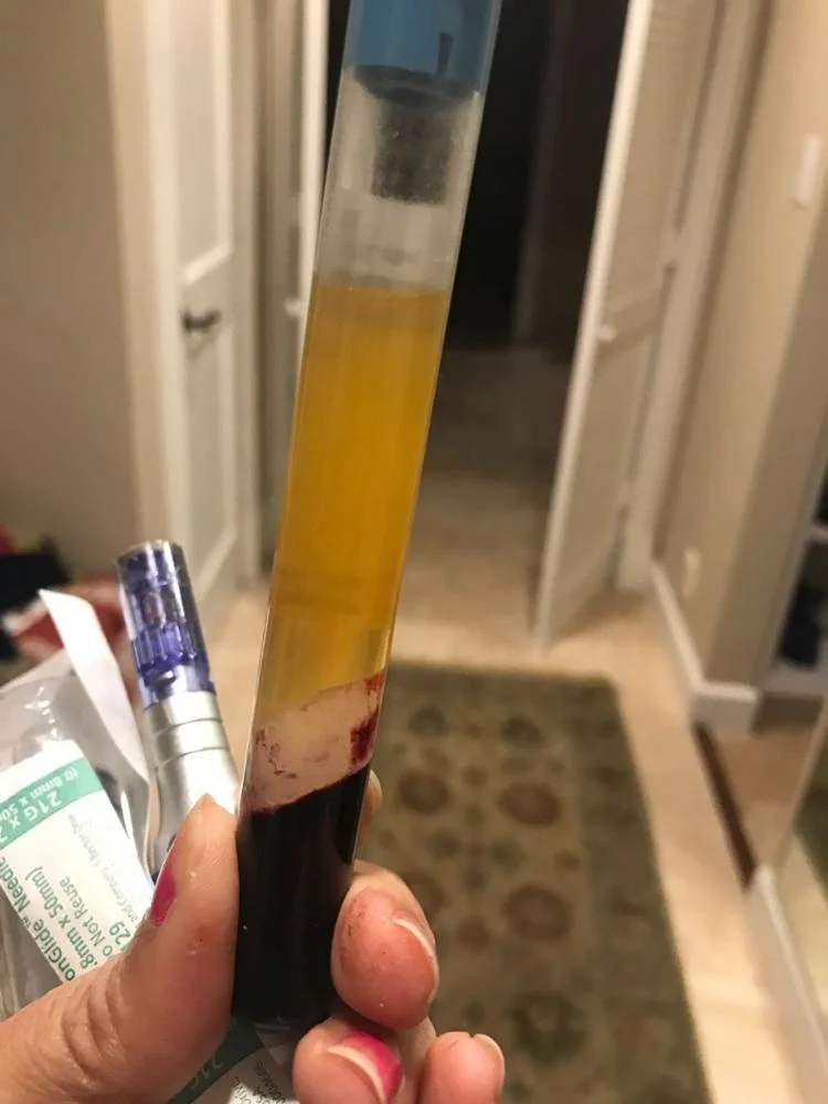 Factory supply prp hair treatment 15ml prp tube with ACDA and gel