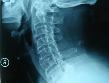 14 х 17in Agfa и Fuji X-Ray blue основан пленка для Agfa 5302 и Fuji 3000/2000/1000