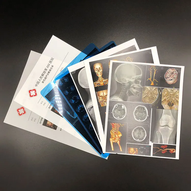 
Medical Radiation Laser Printing Film for Hospital Use 