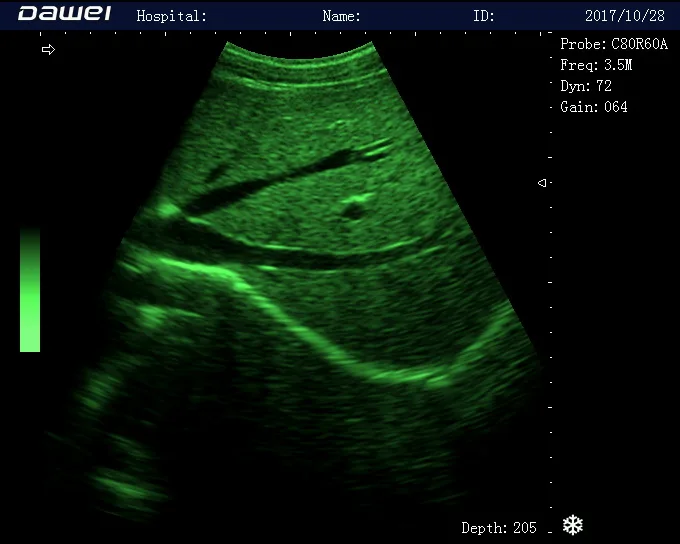 DW-580 портативная, полностью цифровая, ультразвуковая диагностическая система 2d ultrasound portable machine