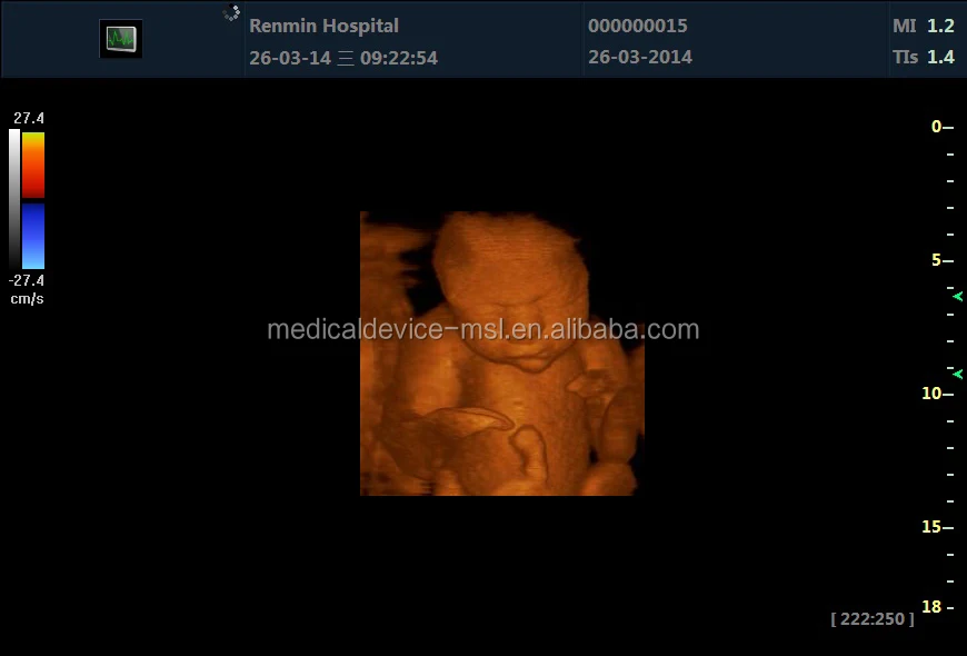 Аппарат USG по разумной цене Ультразвуковой доплеровский сканер 4D для продажи (MSLCU24)