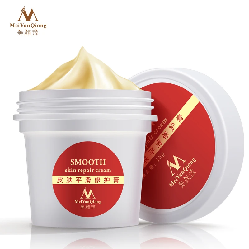 
High Quality Smooth Skin Cream For Stretch Marks Scar Removal To Maternity Skin Repair Body Cream Remove Scar Care Postpartum High Quality Smooth Skin Cream For Stretch Marks Scar Removal To Maternity Skin Repair Body Cream Remove Scar Care Postpartum