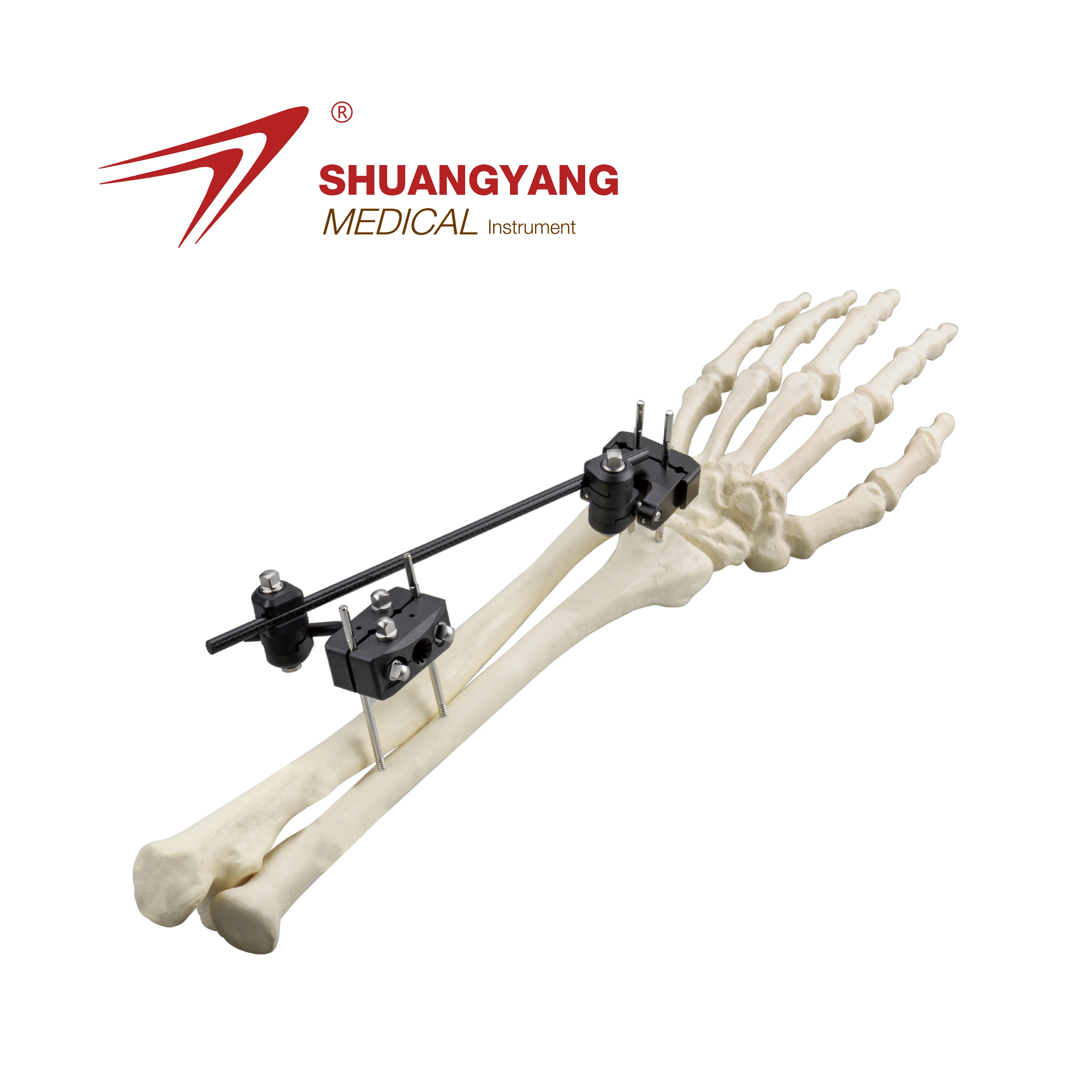 Orthopedic surgical distal radius frame  fracture enternal fixator system