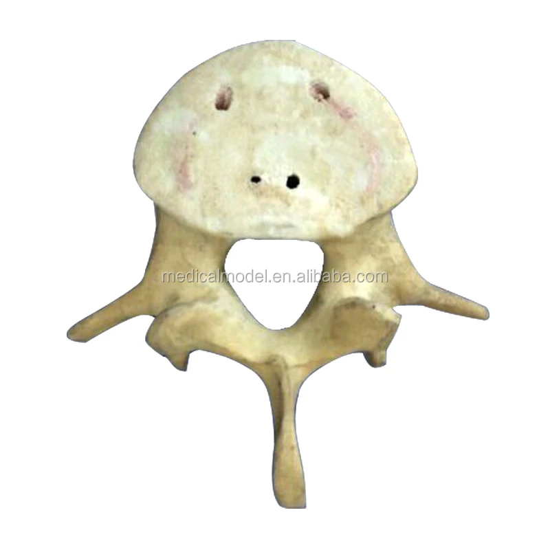 Orthopaedic bones Model For Cut,Drilled, Tapped Or Gouged
