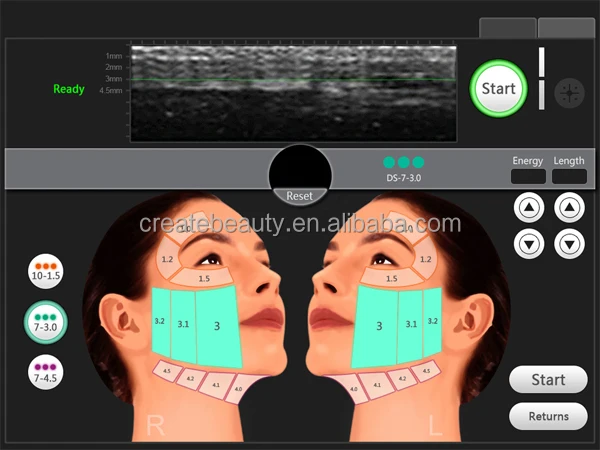 Топ красивая высокой интенсивности сосредоточены Ultrasoundu ультразвуковая липосакция оборудование