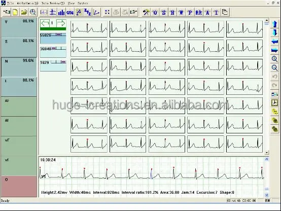 Медицинское устройство holter ecg цифровое 3-канальное для ЭКГ с 3 выводами ручная машина ЭКГ/ЭКГ цена программным обеспечением cd