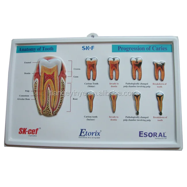 3D Plastic  Embossed Poster Printing Medical Education PVC 3D Poster Printing