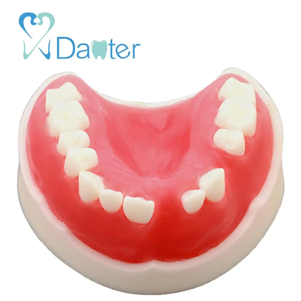 Sell Well Dental Implant Model Partially Edentulous Model for Dental Practice