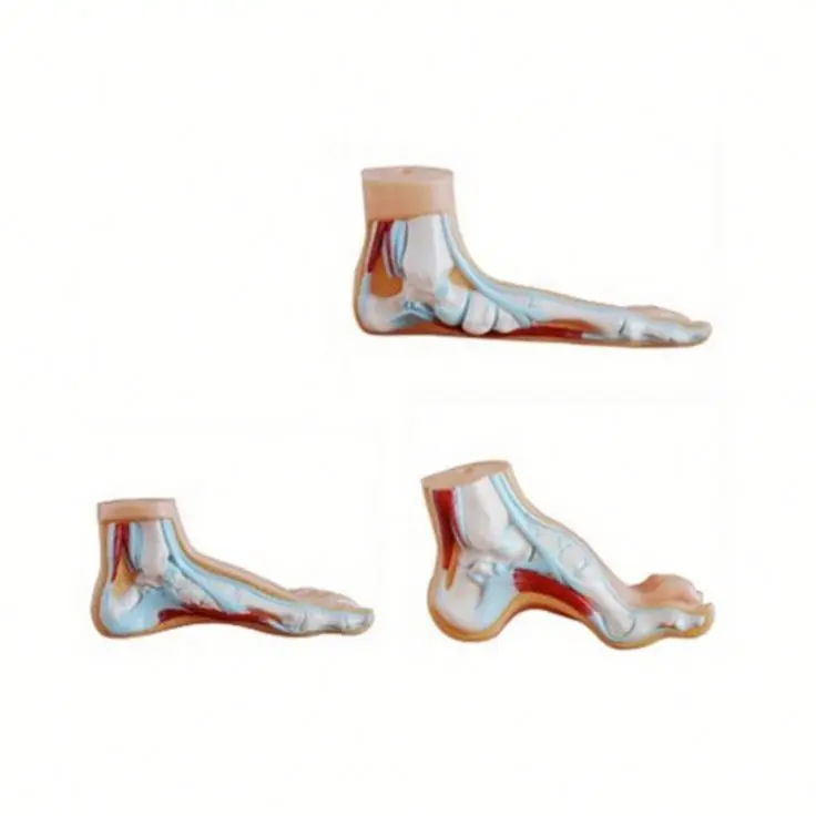 Медицинская модель для здоровой стопы/анатомическая модель человеческой стопы (плоскостопия, клоупа)