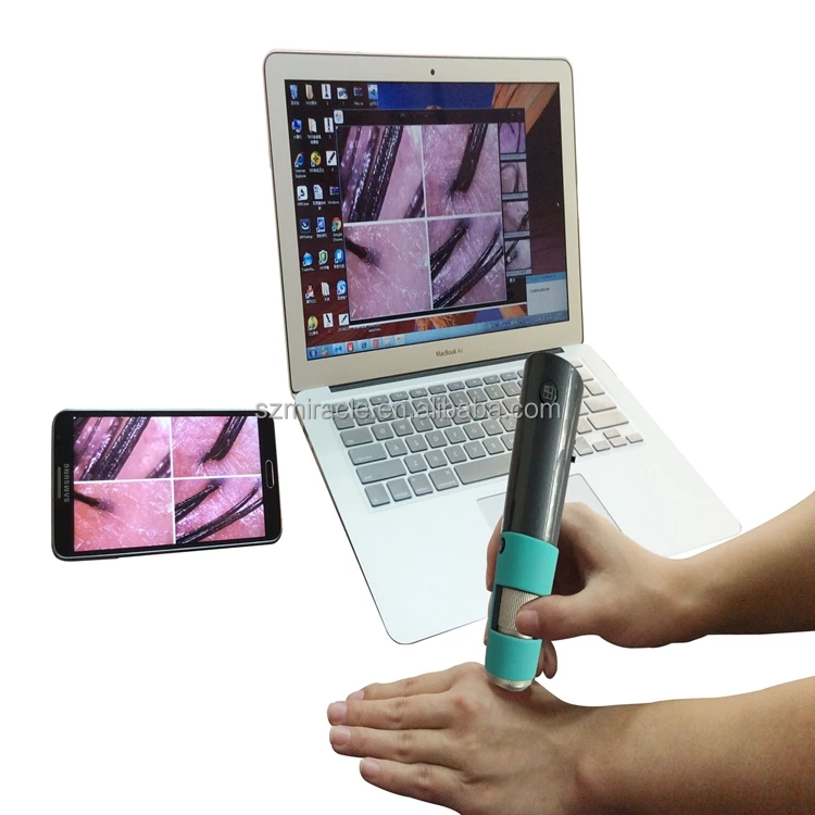 HD scalp camera wirelessly connected to mobile phones and tablets compatible with Android iOS windos system