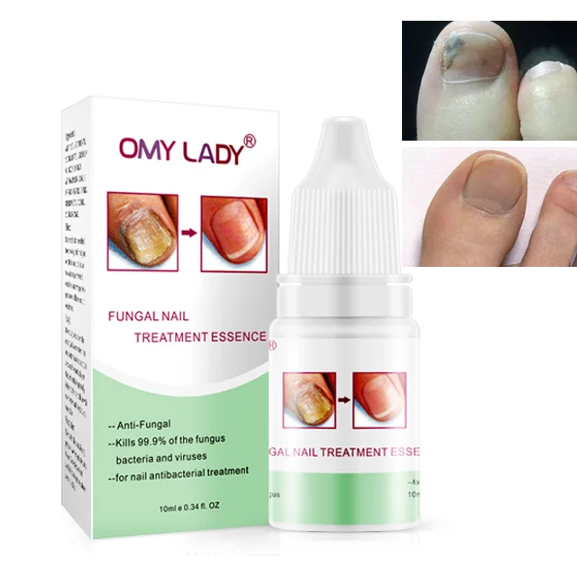 Nail Repairing OMY LADY Medical Certificated Anti Fungal Nail Solution