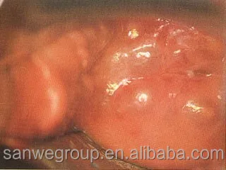 SW-3304 Digital Video Colposcope, Vaginal Colposcope with Camera, Video Colposcope